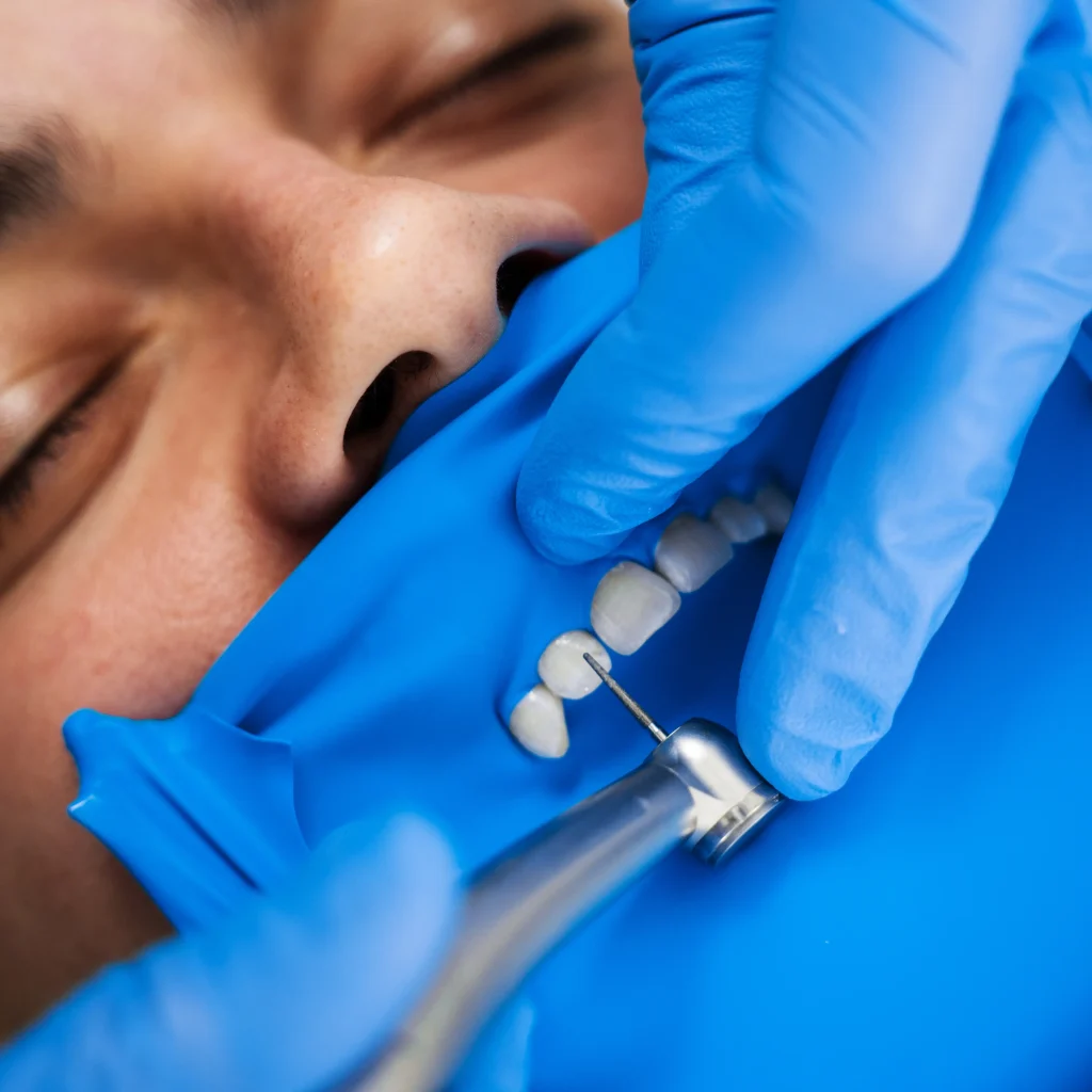 REHABILITACION ORAL